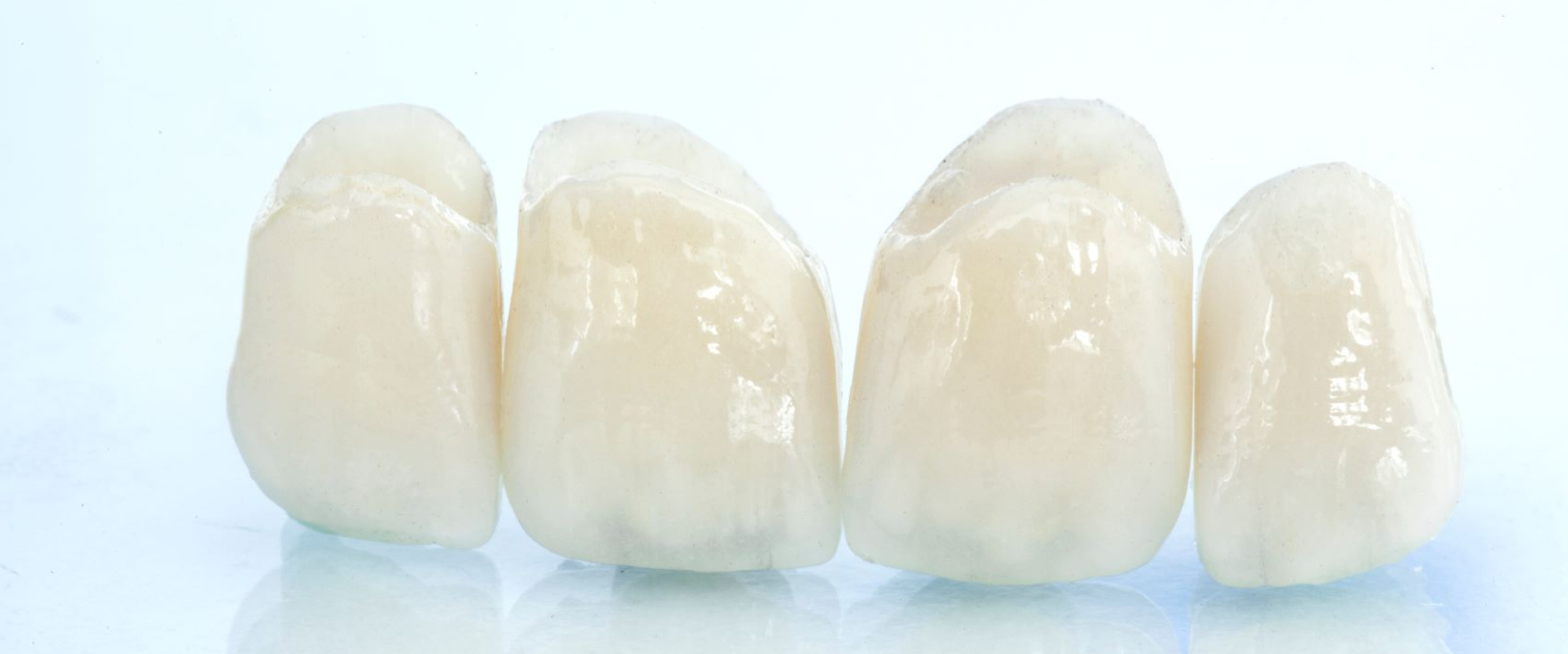 つめ物・かぶせ物